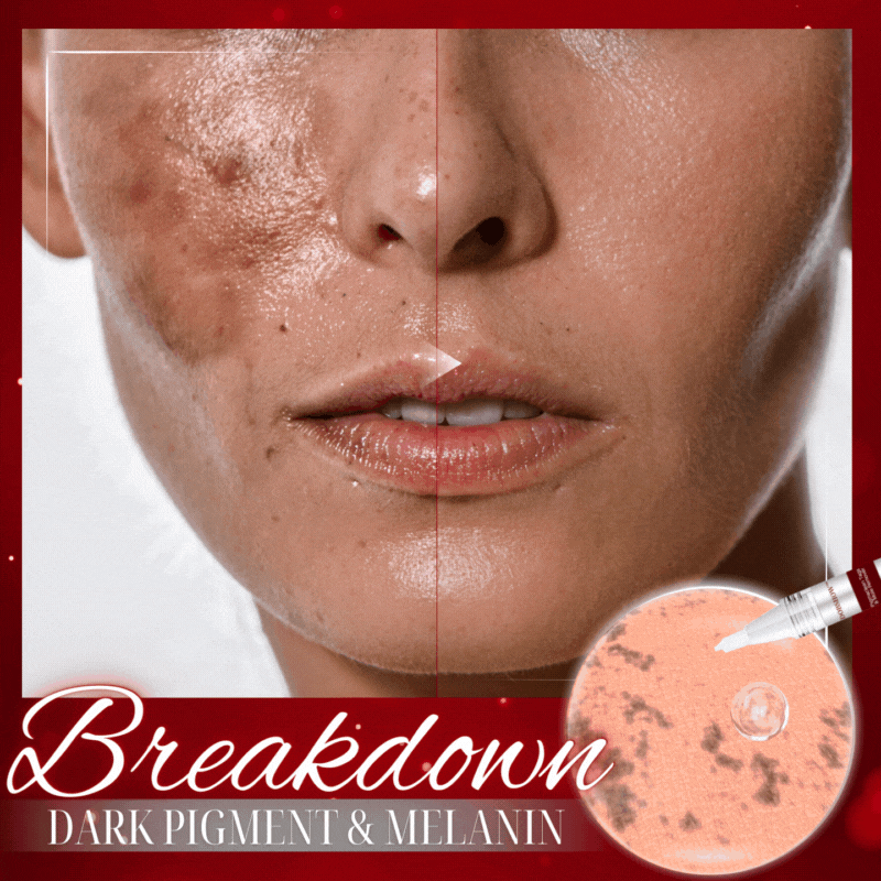 Dobshow™ Pigmaclean Tags & Mole Remover